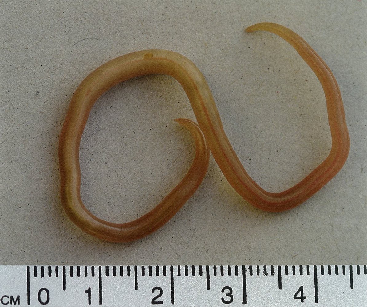 Ascaris lumbricoides (giant roundworm)