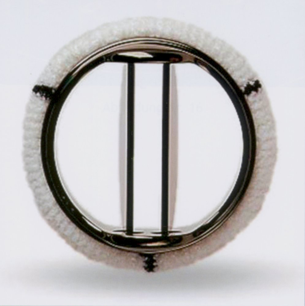 Bileaflet mechanical prosthetic heart valve
