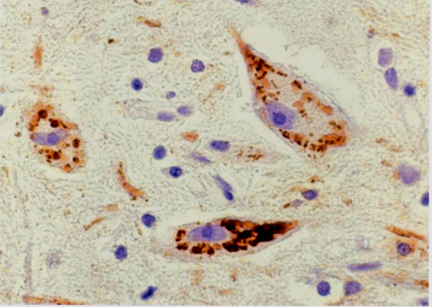 Ganglion cell with Negri bodies
