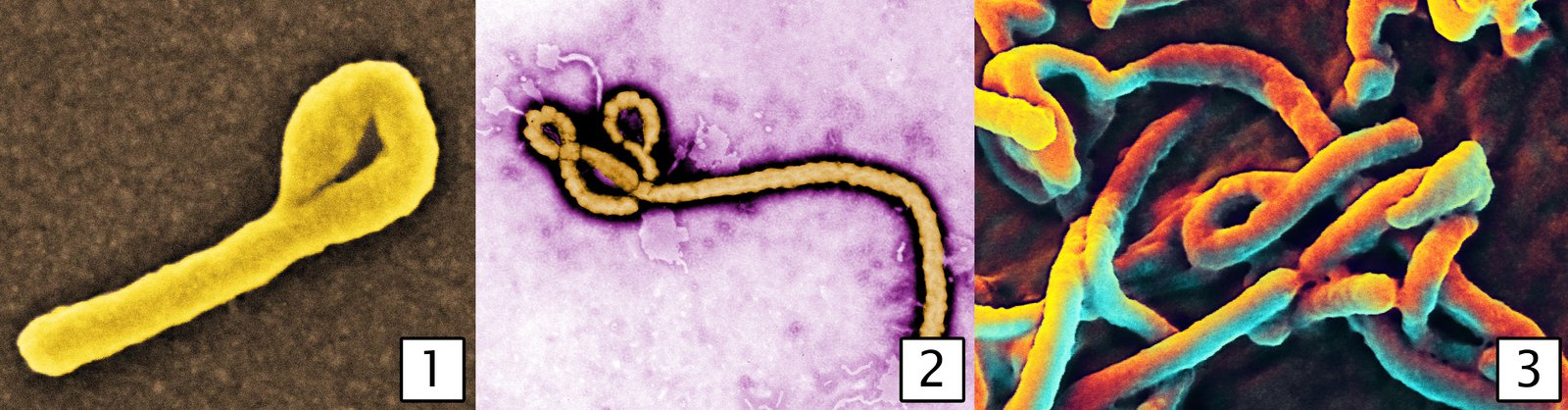 Ebola virus