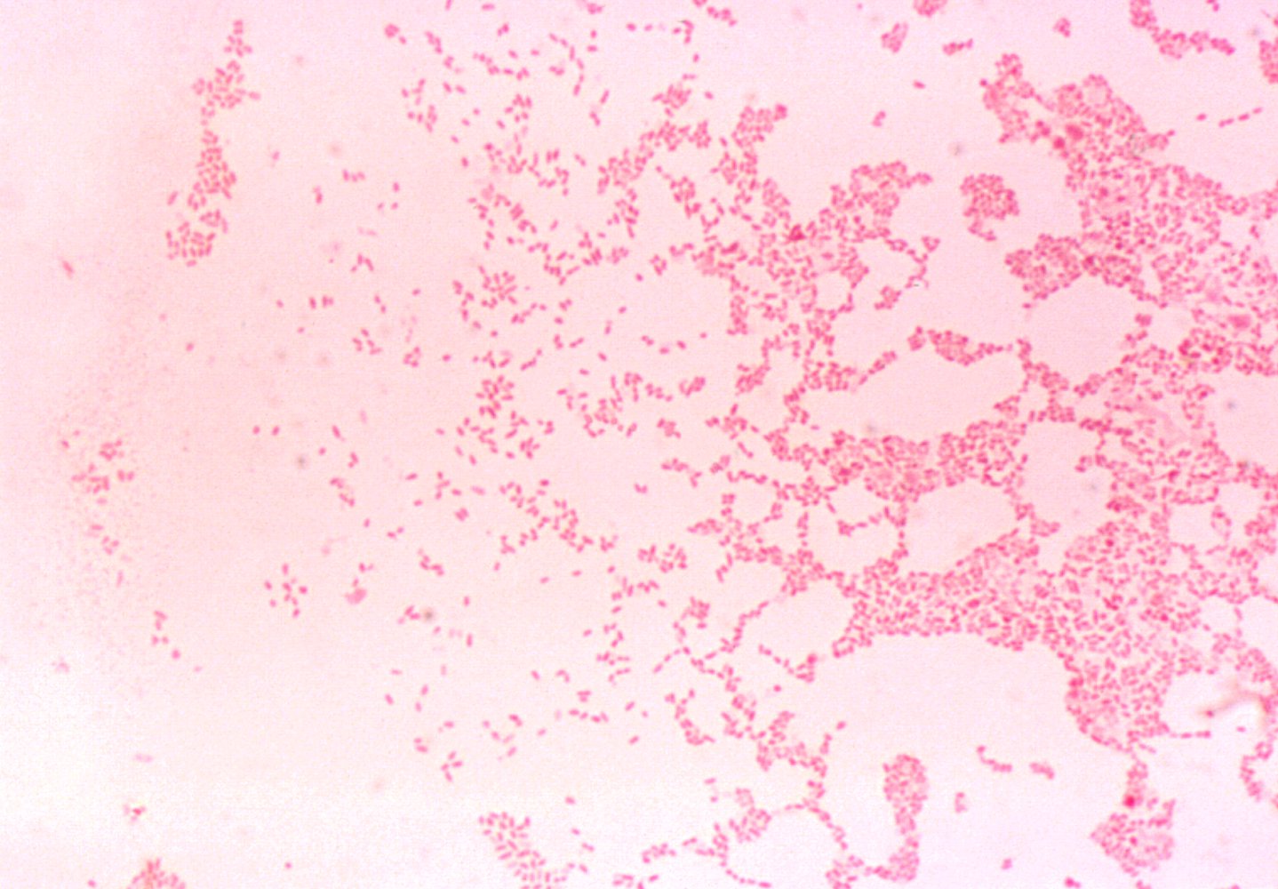 Brucella melitensis