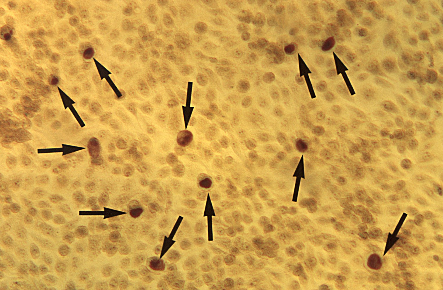 Chlamydia trachomatis in McCoy cell culture