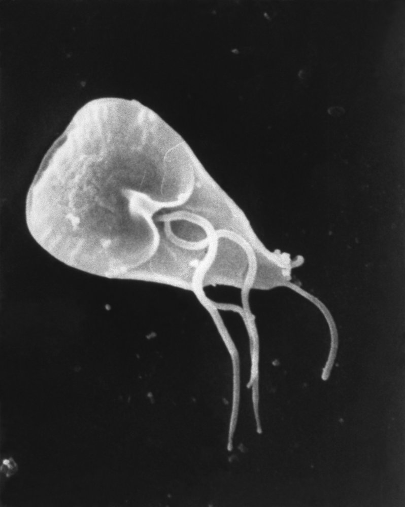 Giardia lamblia (trophozoite)