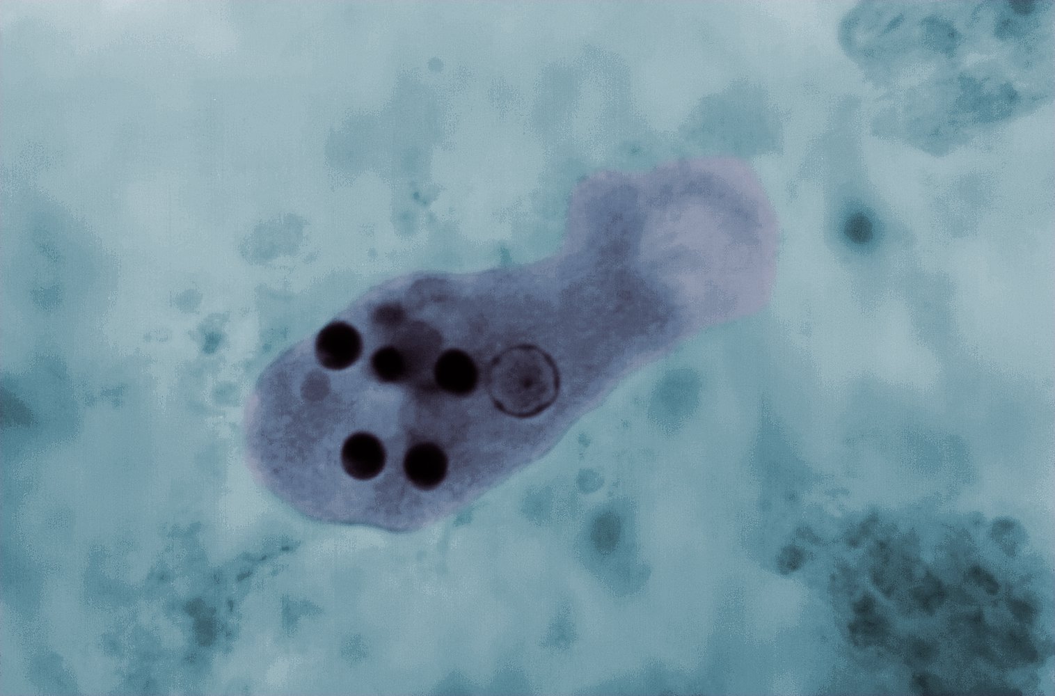 Entamoeba histolytica (trophozoite)