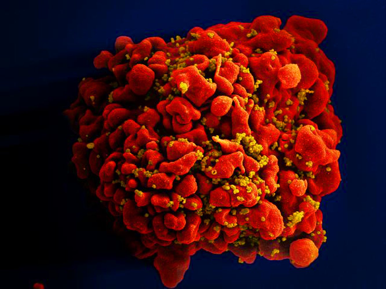 HIV-infected T cell