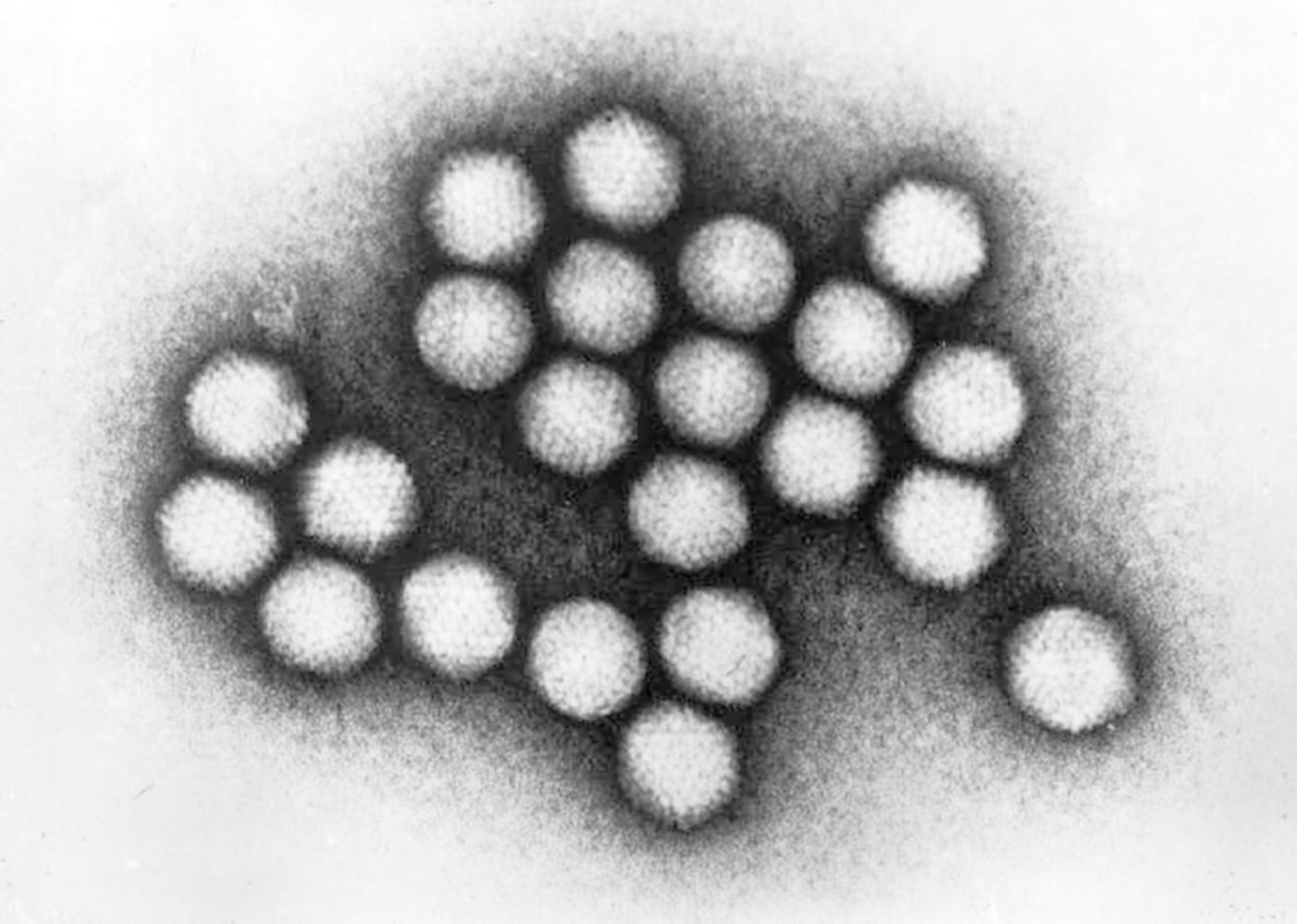 Adenovirus