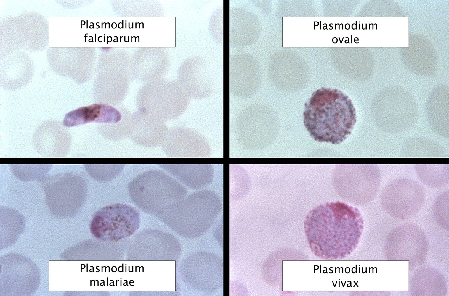 Macrogametocytes of different types of Plasmodium