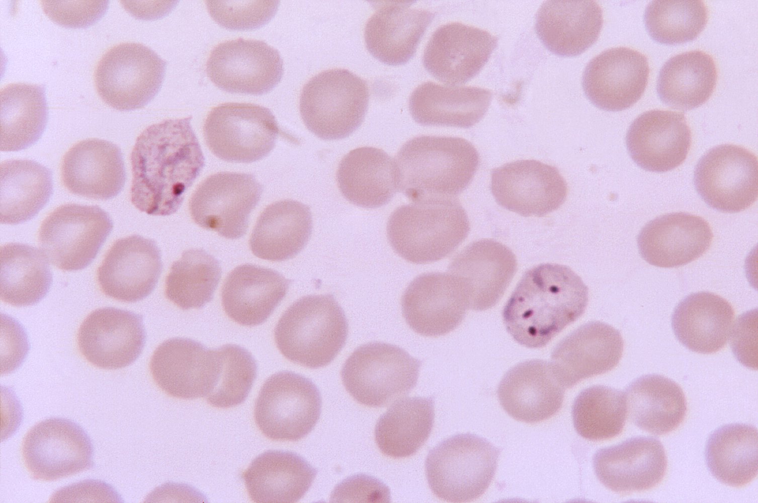 Immature and mature trophozoite (Plasmodium vivax)