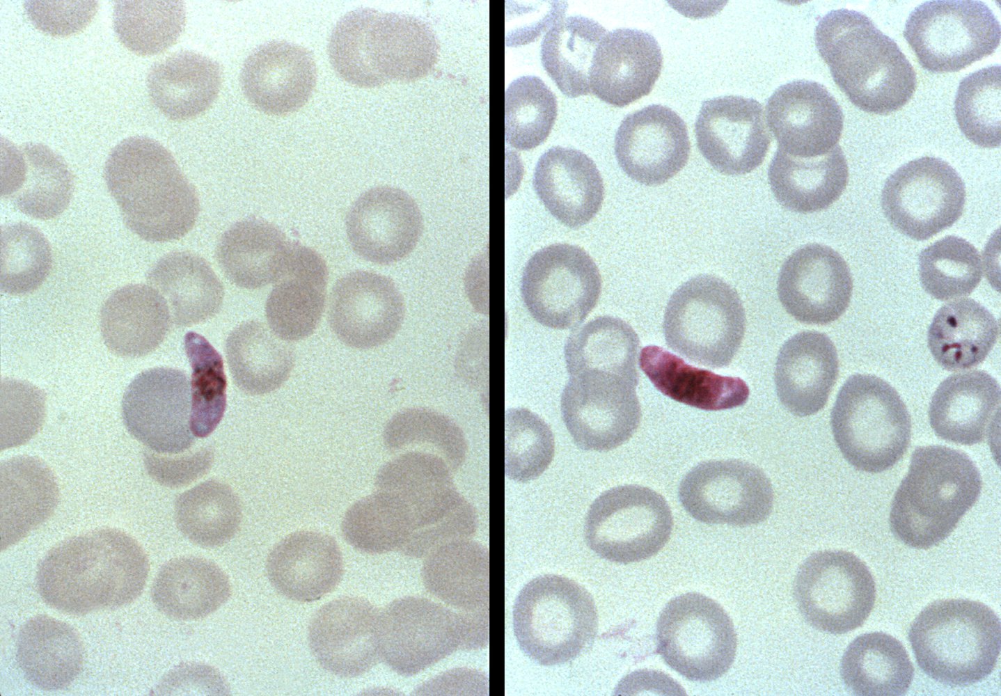 Microgametocyte and macrogametocyte of Plasmodium falciparum