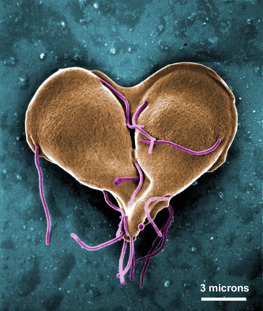 Giardia lamblia during replication