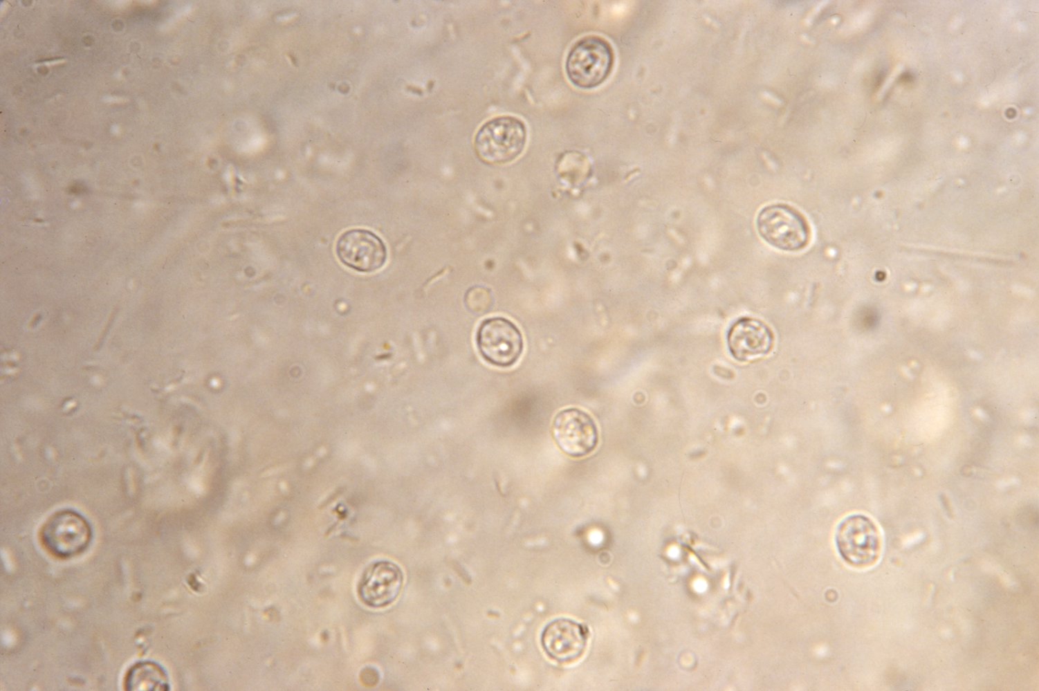 Cryptosporidium parvum oocysts