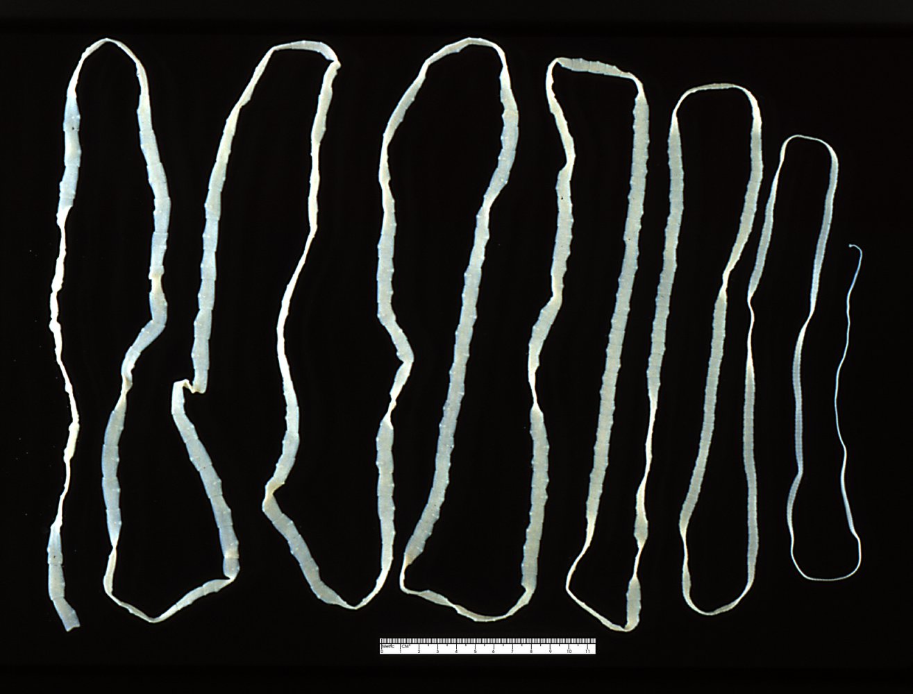 Beef tapeworm (Taenia saginata)