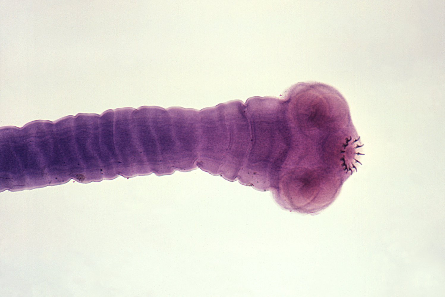 Head of a pork tapeworm (Taenia solium)