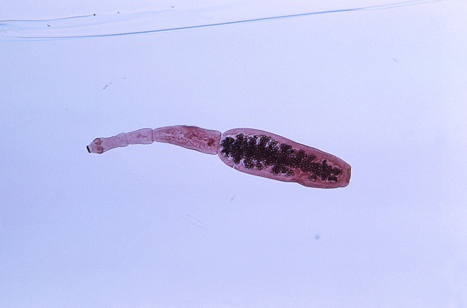Adult Echinococcus granulosus