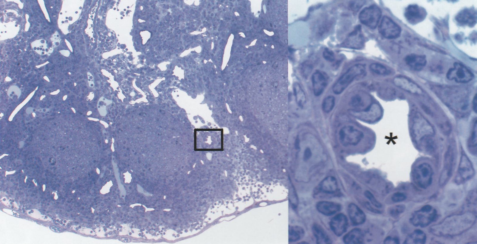 Microstructure of a lymph node