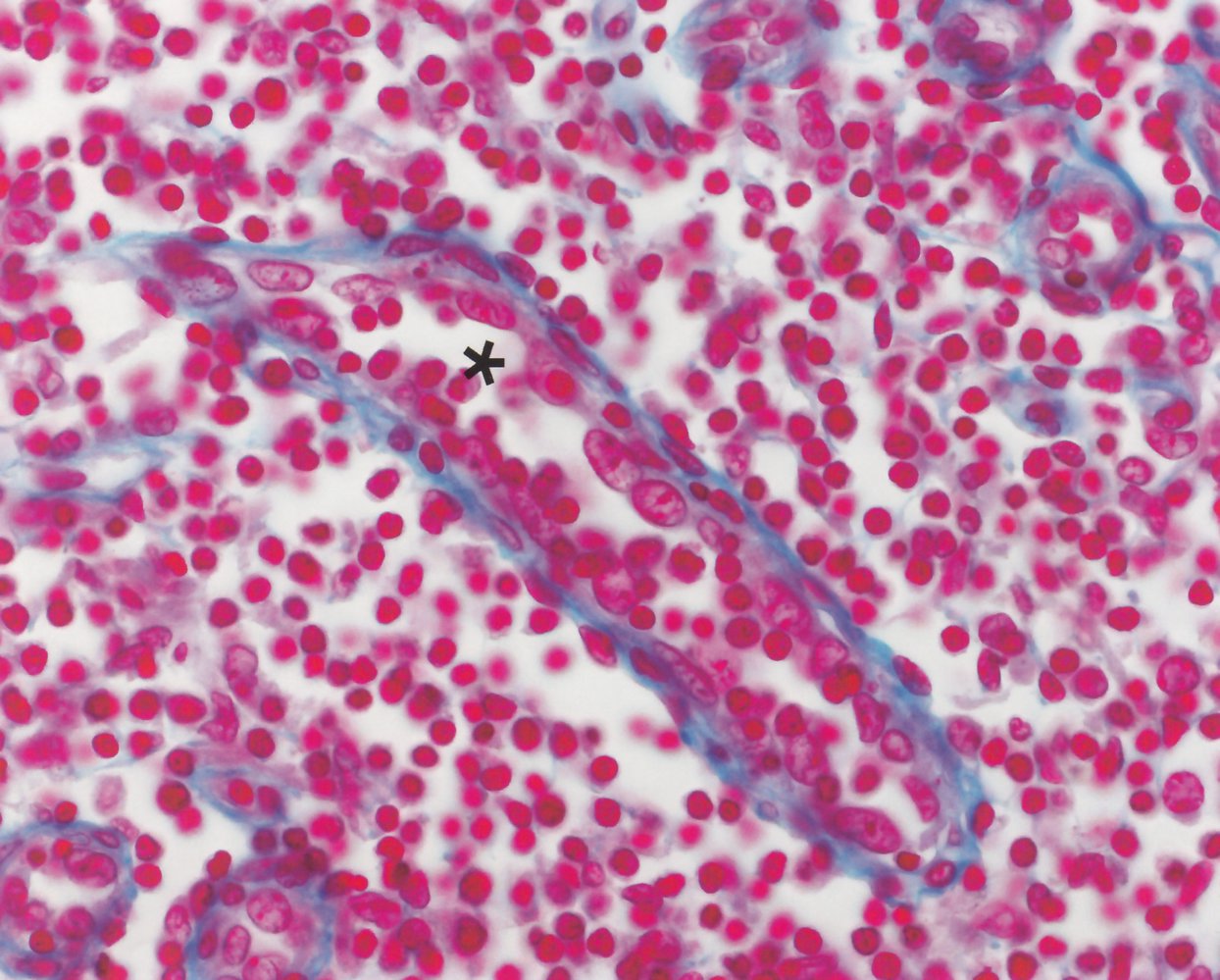 High endothelial venule