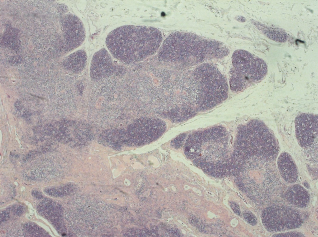 Thymus
