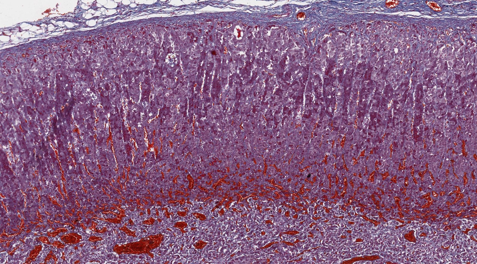 Transition zone of the adrenal cortex to the adrenal medulla