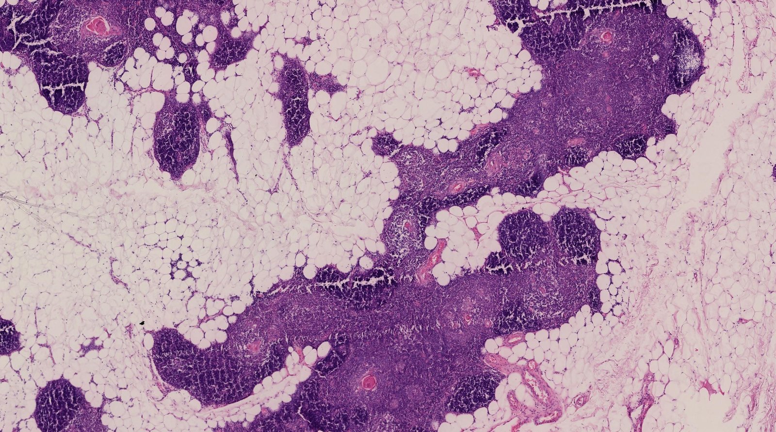 Thymus (adult)