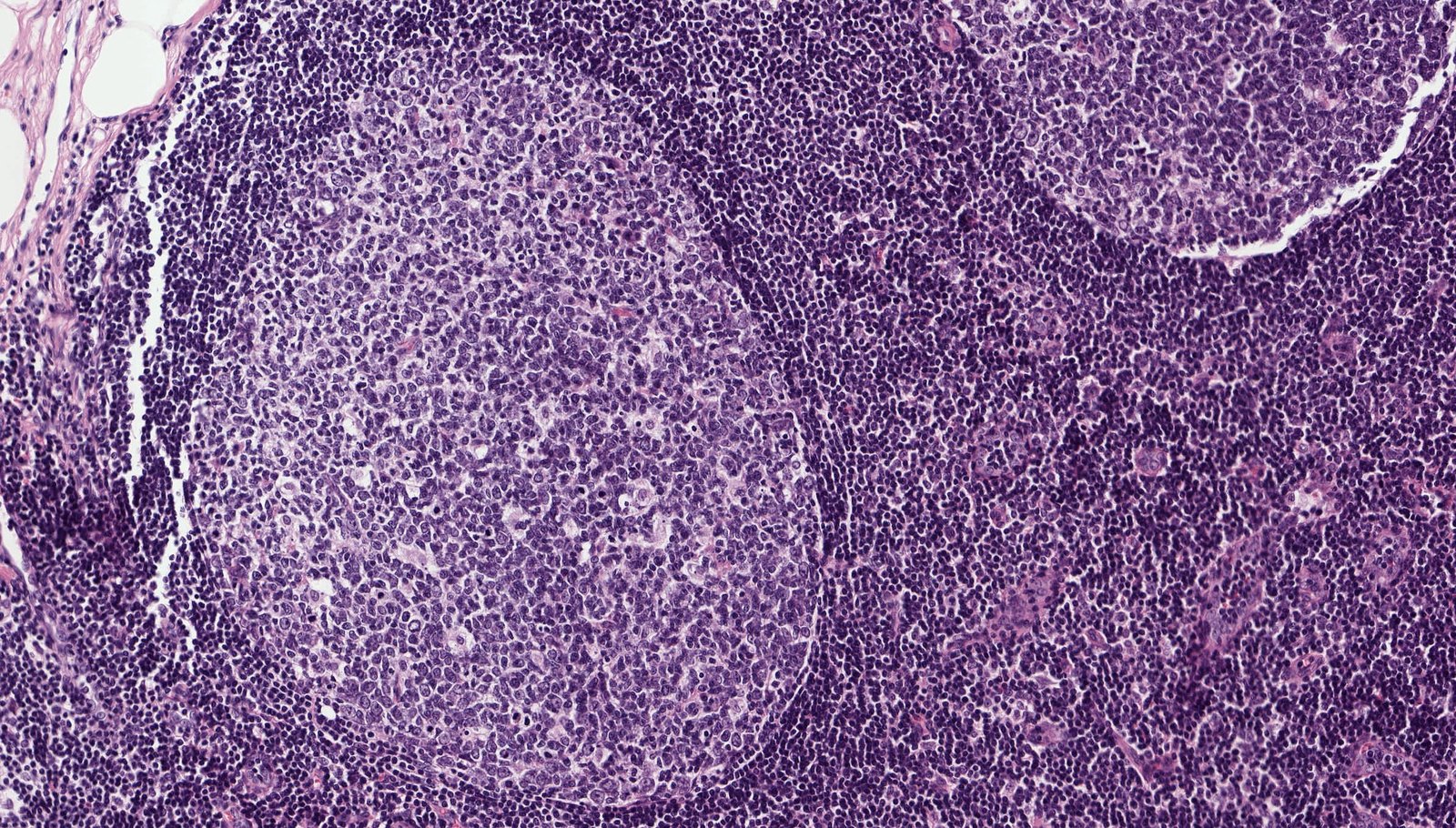 Germinal center