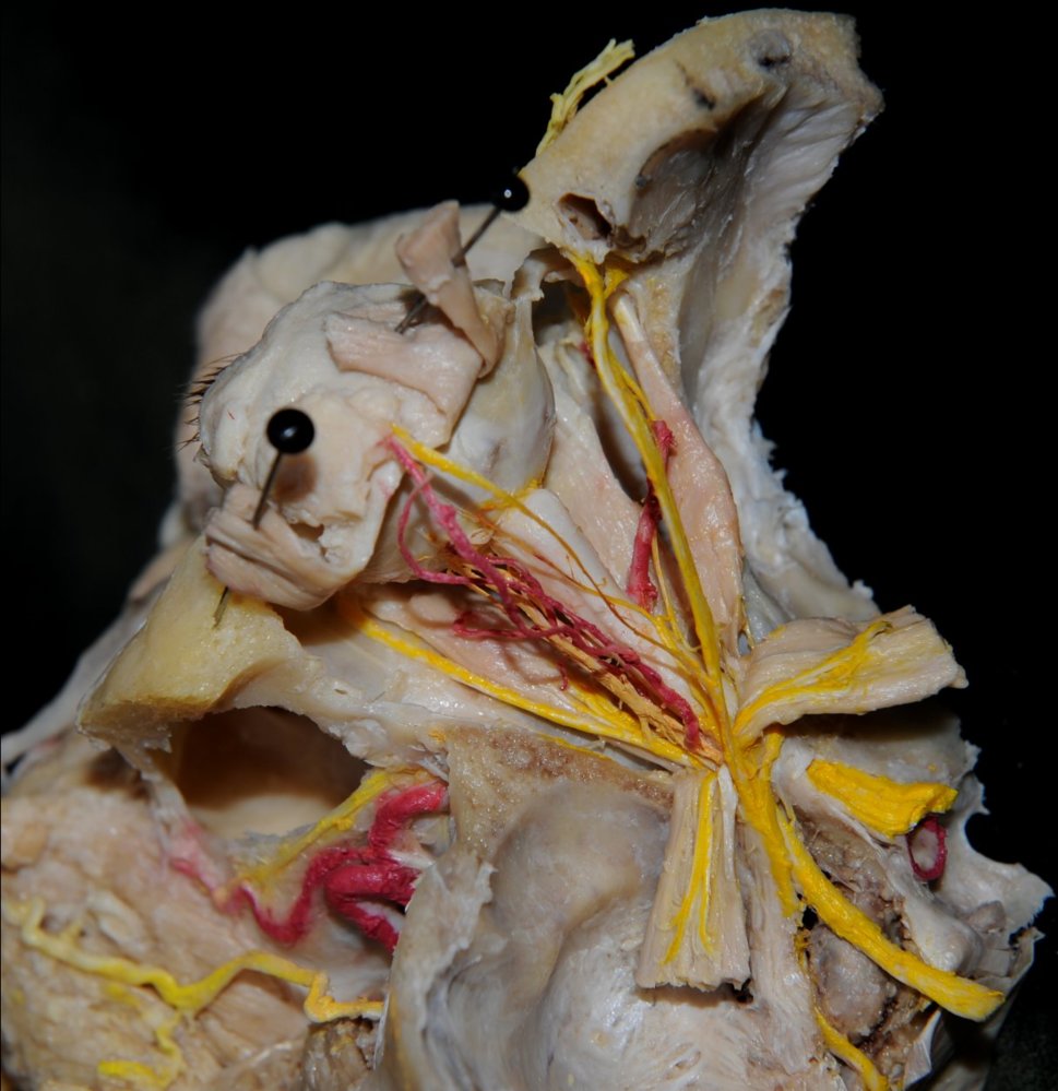 Orbit and cavernous sinus