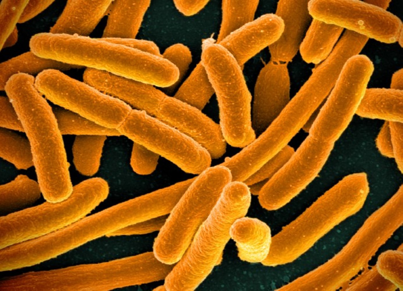 Escherichia coli