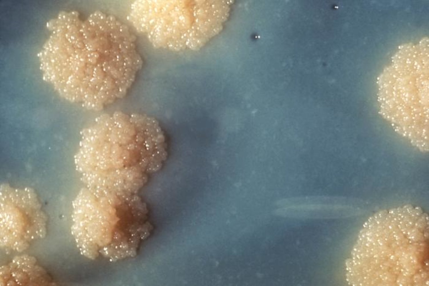 Mycobacterium tuberculosis culture