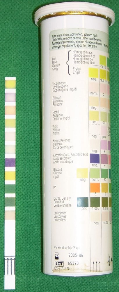 Urinalysis (urine analysis) test strip