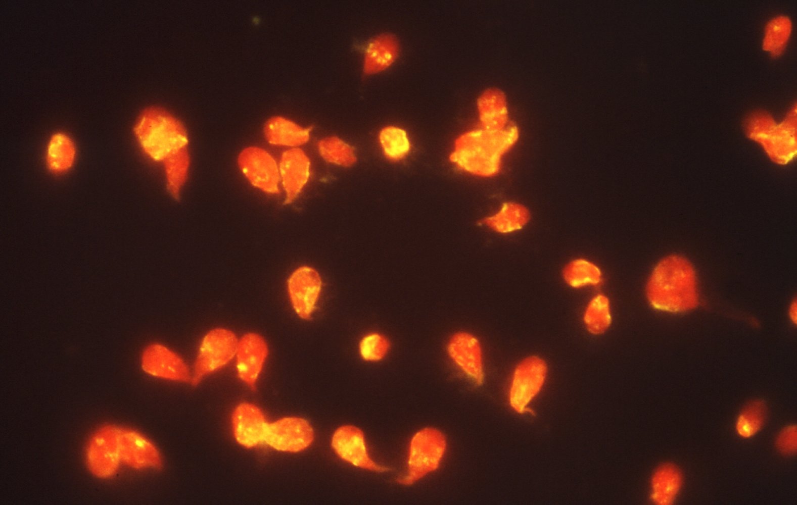 Giardia lamblia