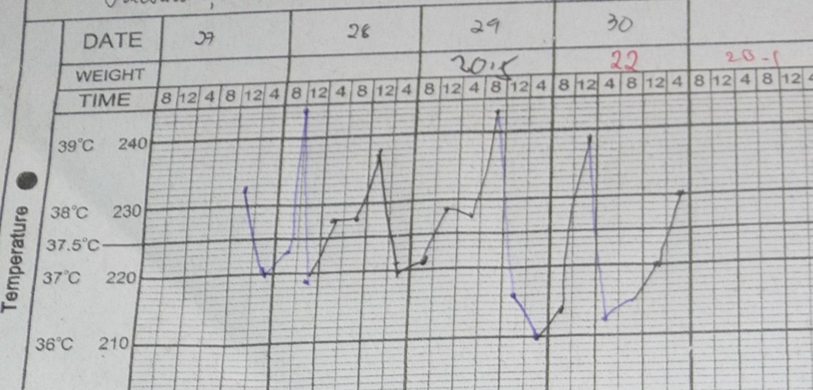 Temperature curve in typhoid fever