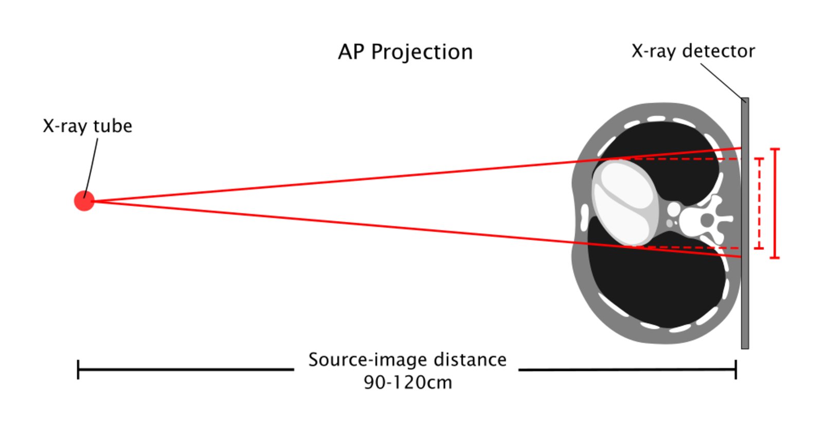 Anteriorposterior view