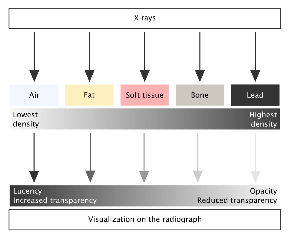 Radiopacity of tissues