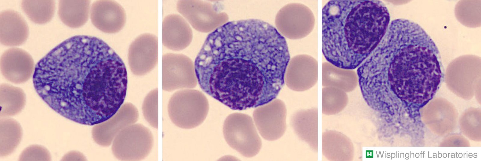 Plasma cells