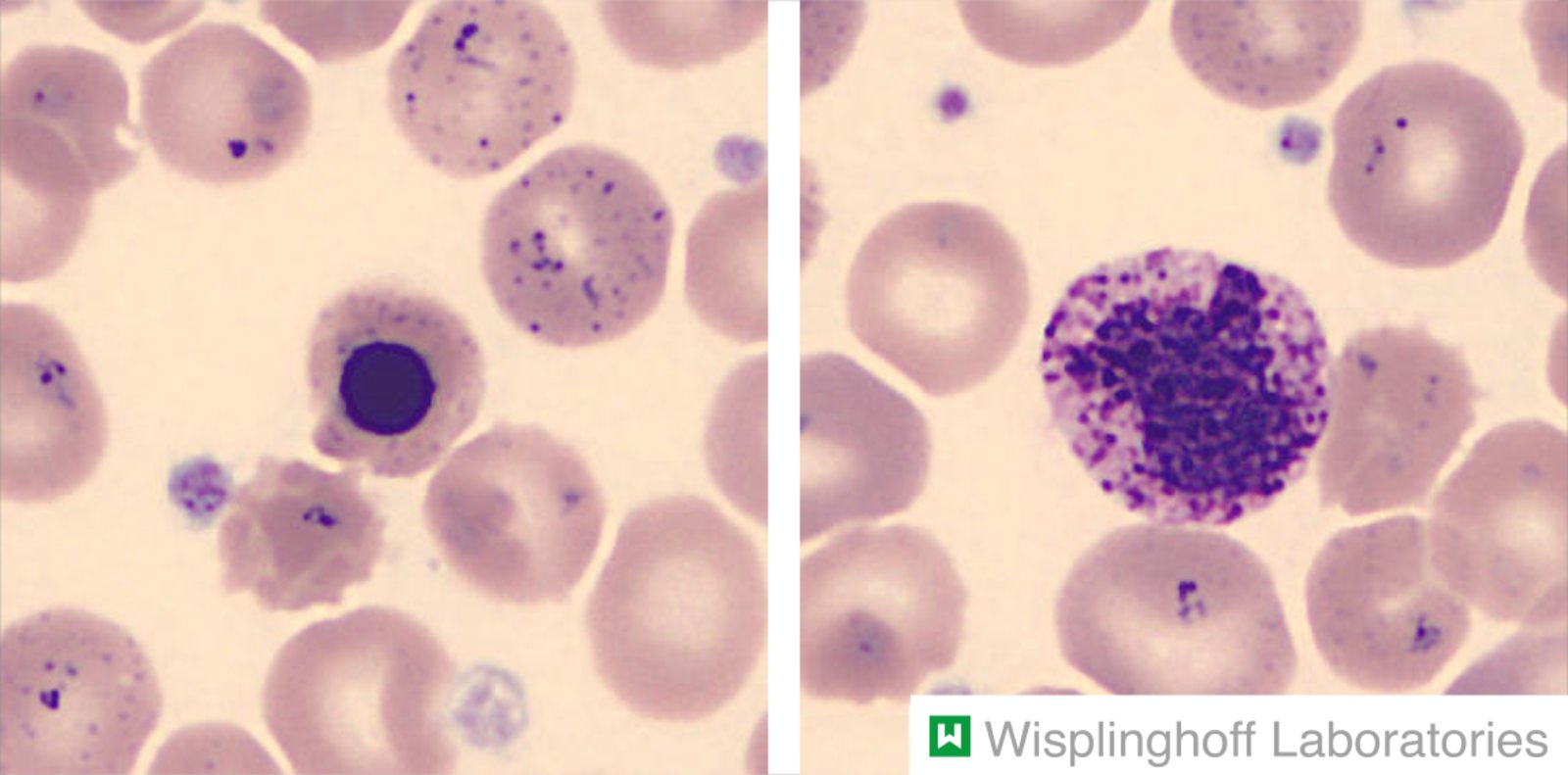 Basophilic stippling of erythrocytes
