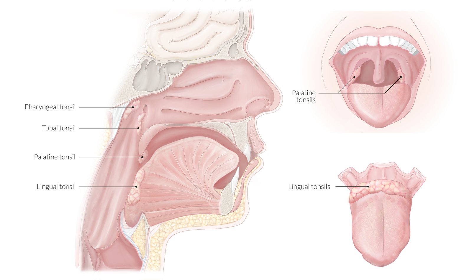 Location of tonsils