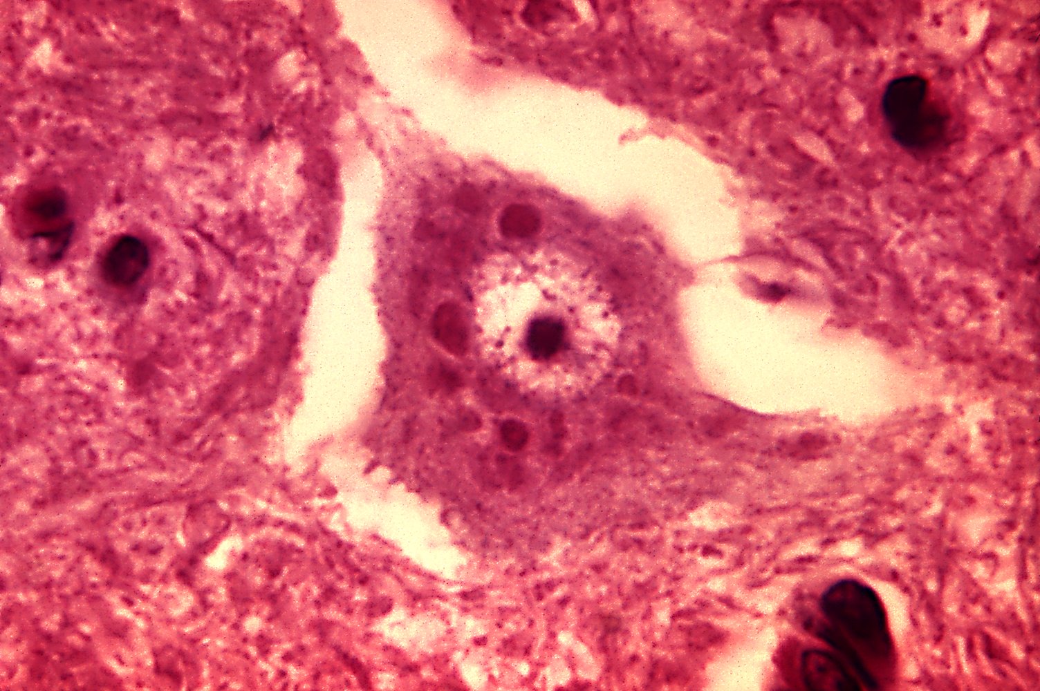 Negri bodies in a neuron