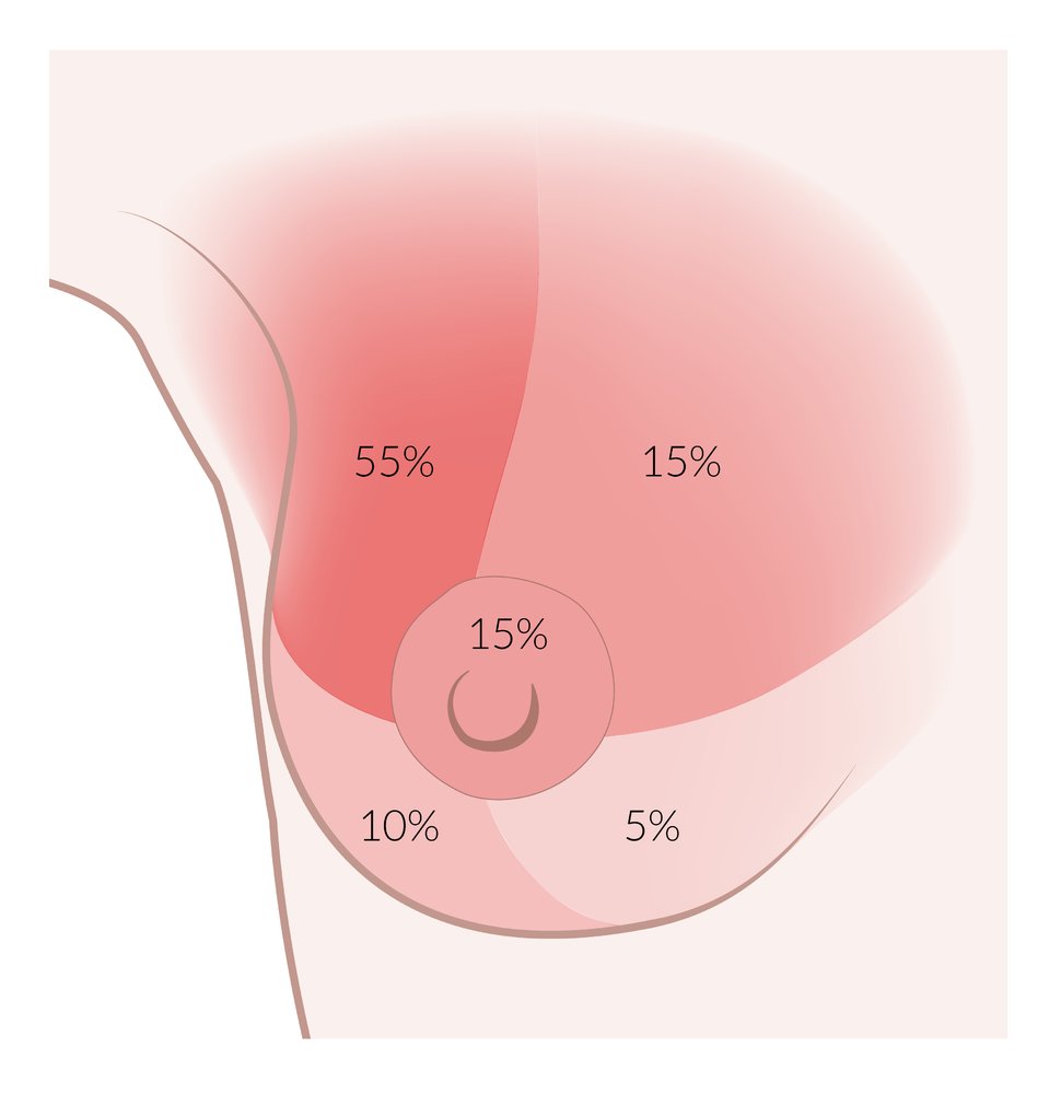 Breast cancer incidence by location