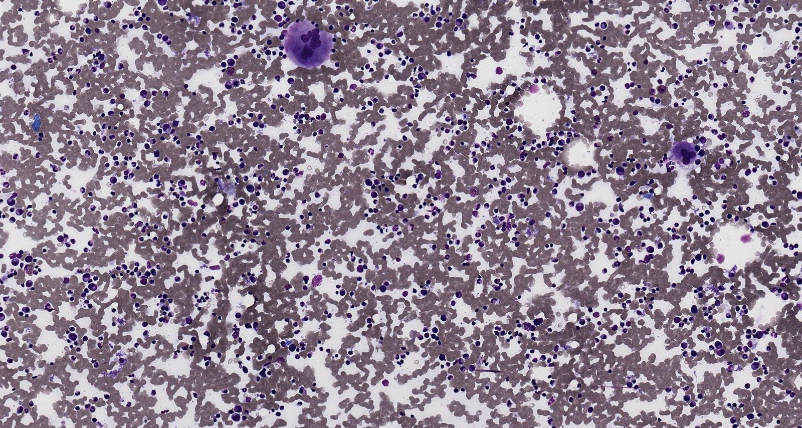 Normal bone marrow smear