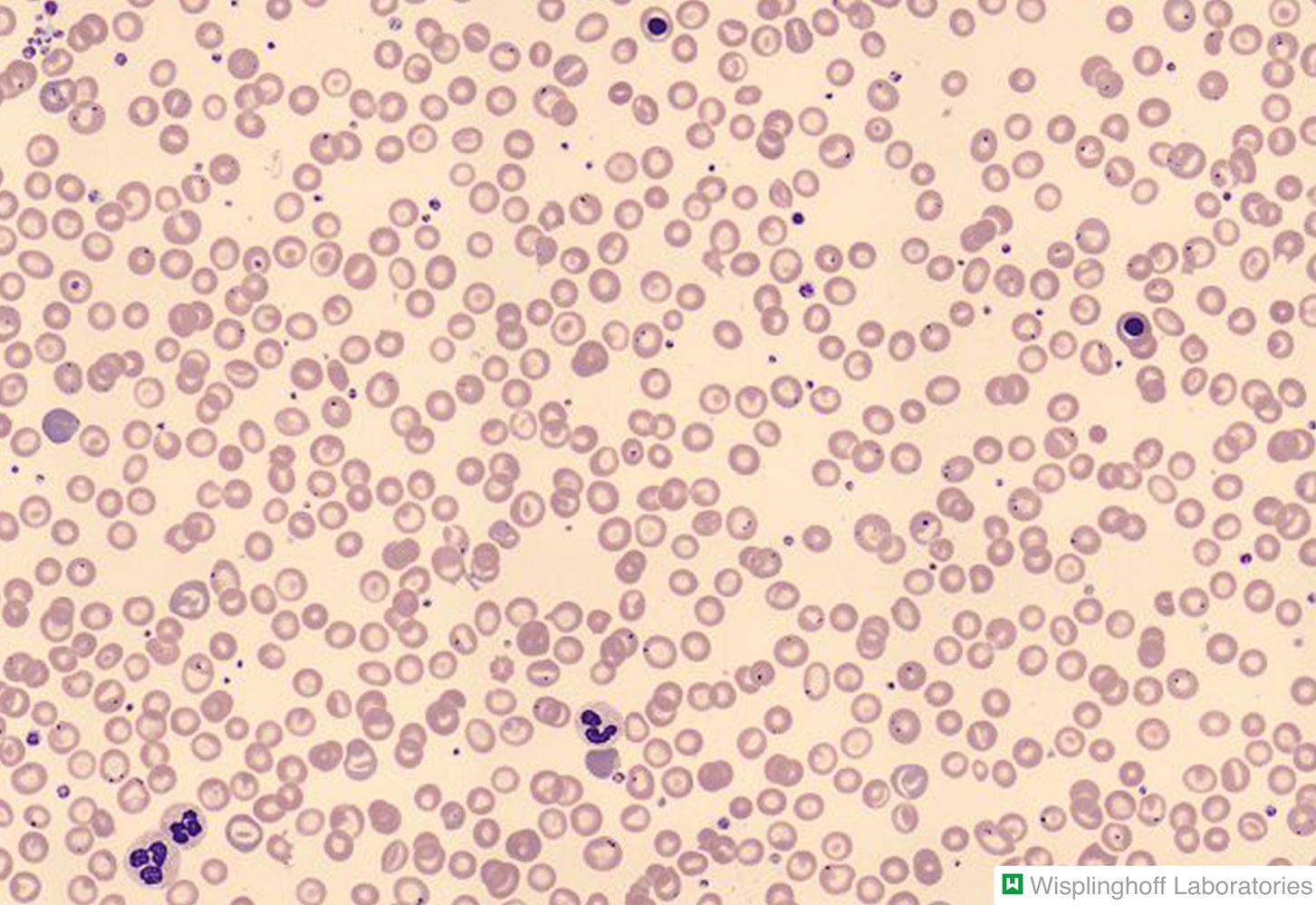 Target cells (codocytes)