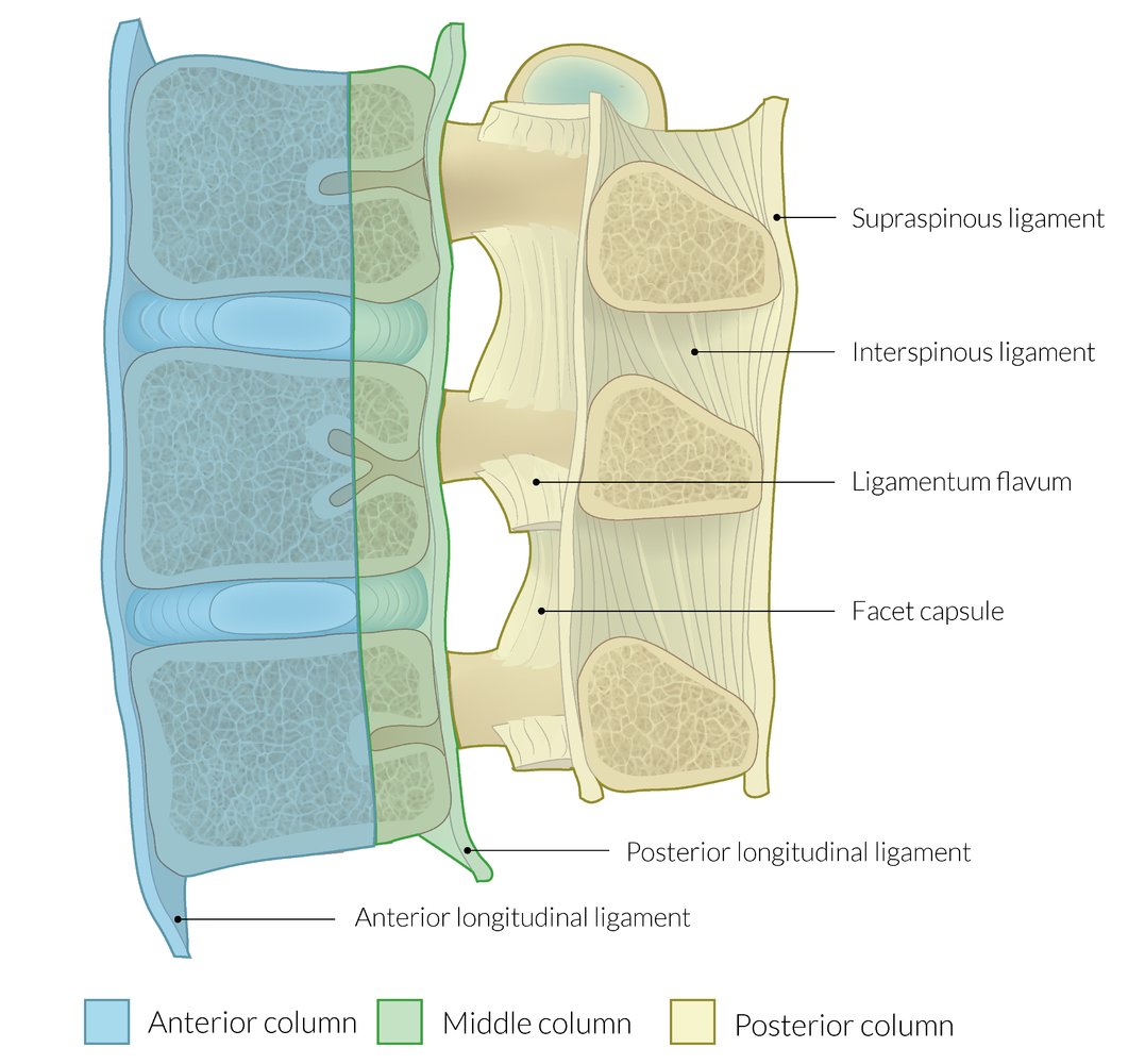 Denis' three-column classification of spinal instability in thoracolumbar injuries