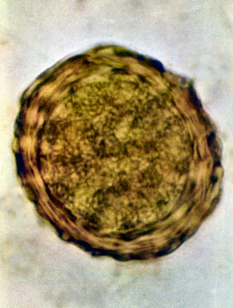 Ascaris lumbricoides fertilized egg