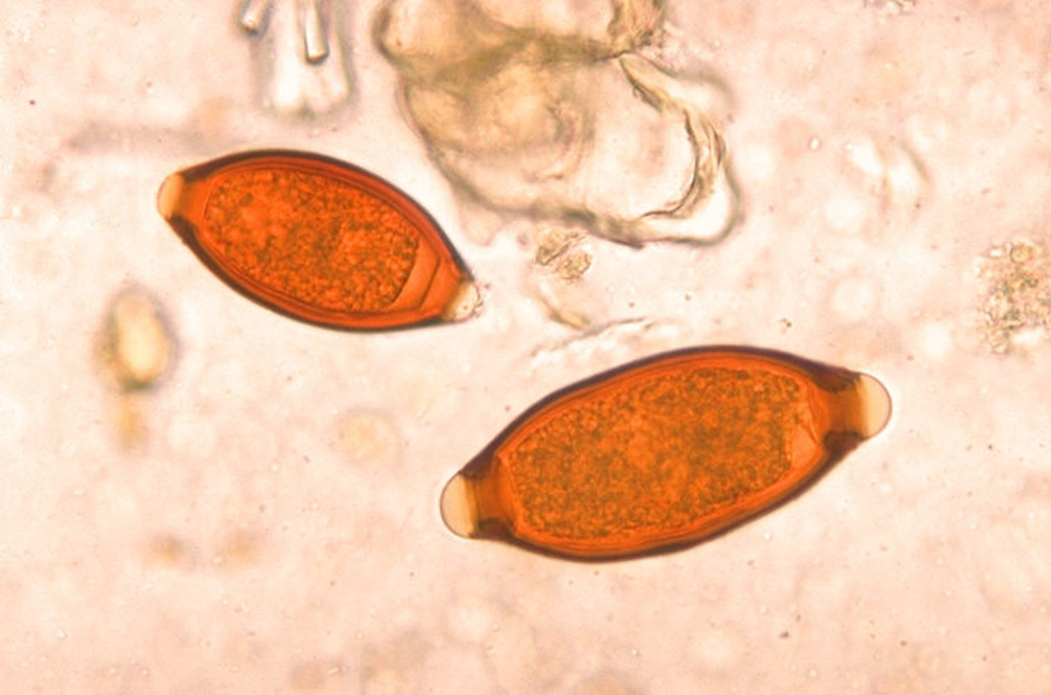 Trichuris trichiura eggs