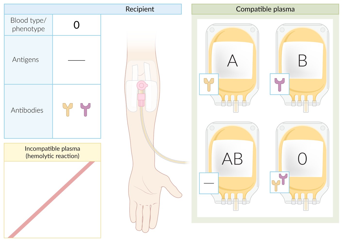 Blood type O plasma transfusion compatibility