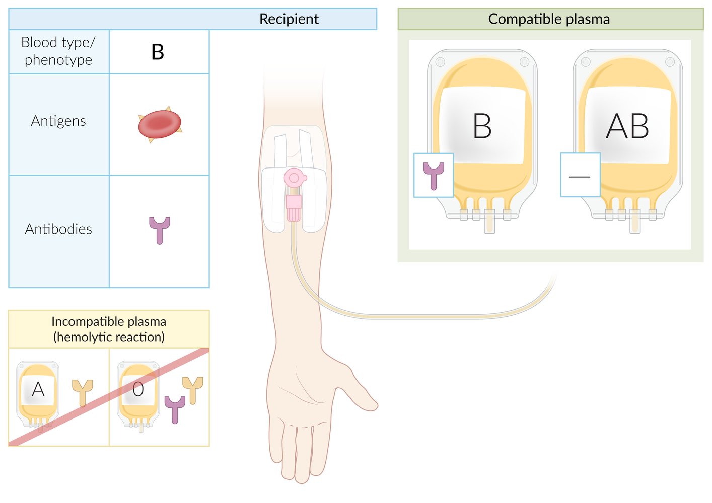 Blood type B plasma transfusion compatibility