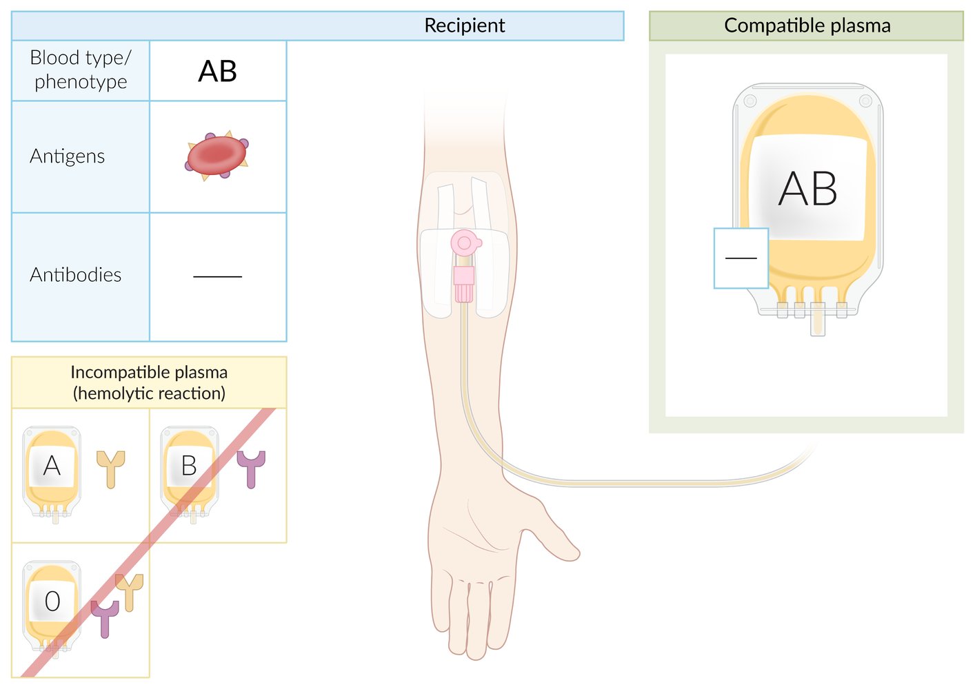 Blood type AB plasma transfusion compatibility
