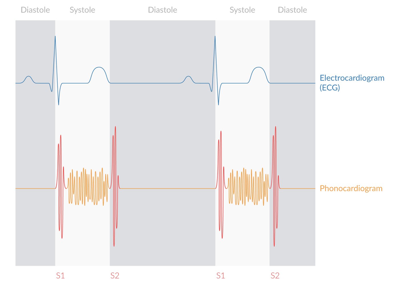 Heart murmur in ventricular septal defect, mitral regurgitation, and tricuspid regurgitation
