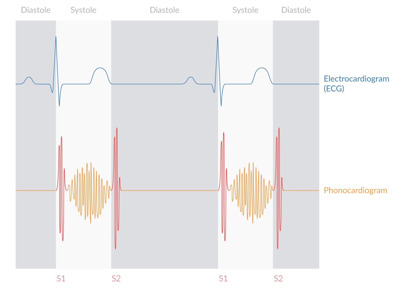 Heart murmur in hypertrophic obstructive cardiomyopathy, aortic stenosis, and pulmonary stenosis