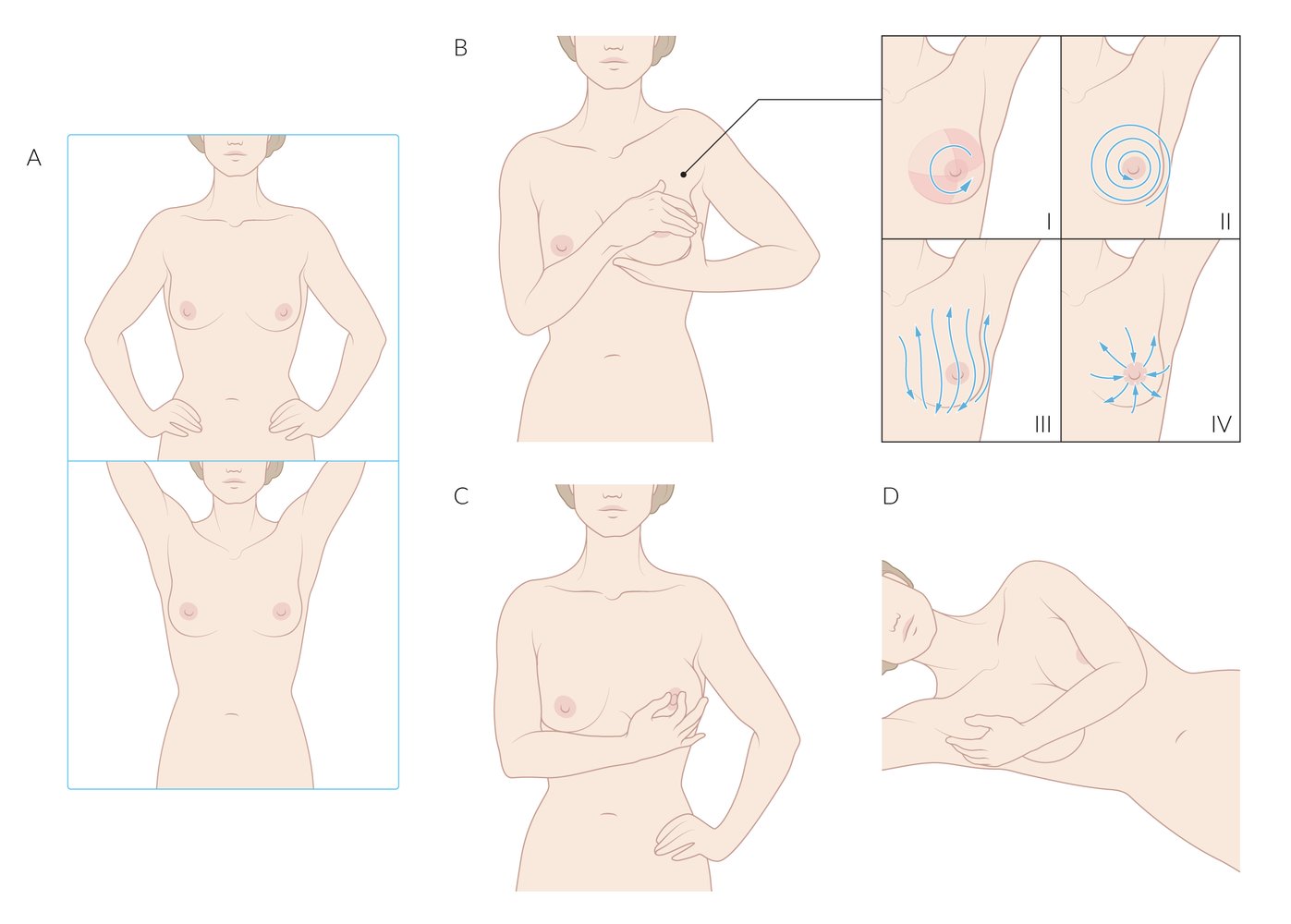 Breast self-examination