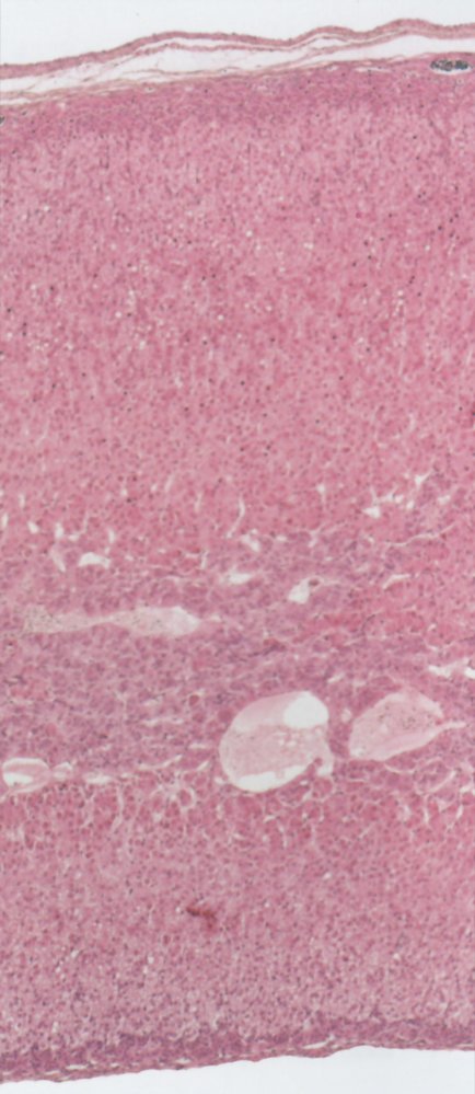 Adrenal gland