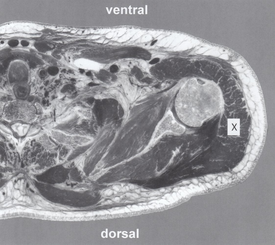 Normal MRI left shoulder region